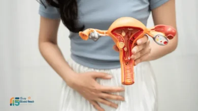 علاج تليف الرحم بالثوم