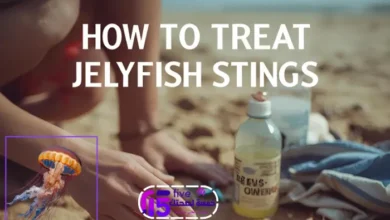 كيفية علاج لسعات قنديل البحر