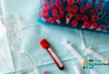 تحليل TMS للاطفال