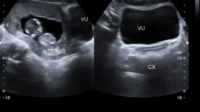 كيس حمل كبير