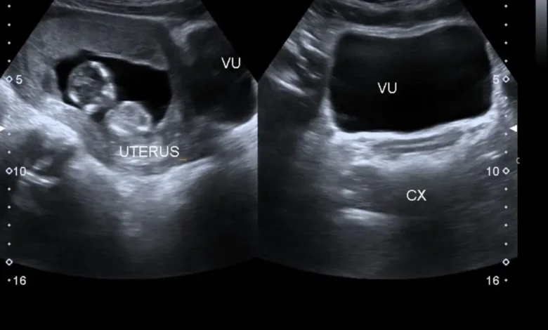 كيس حمل كبير