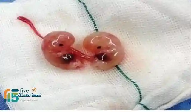 ابي شي ينزل الحمل في الشهر الاول