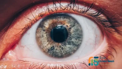 التهاب العنبية