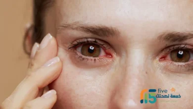 التهابات قزحية العين