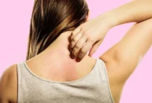 أسباب حكة الجسم عند النساء