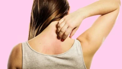 أسباب حكة الجسم عند النساء