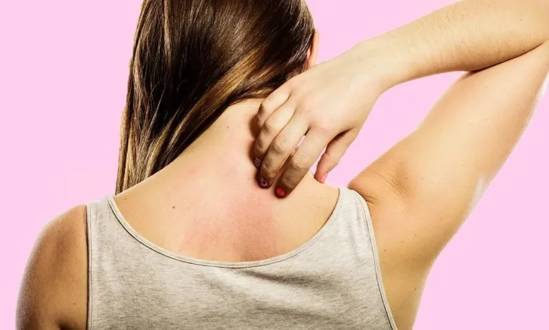 أسباب حكة الجسم عند النساء