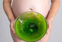 أسباب الإفرازات الخضراء بدون رائحة للحامل