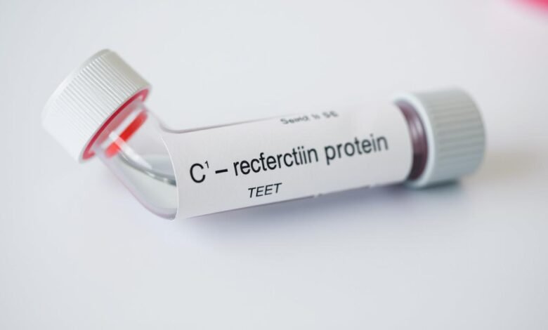 ما هو تحليل CRP ومتى يجب إجراؤه