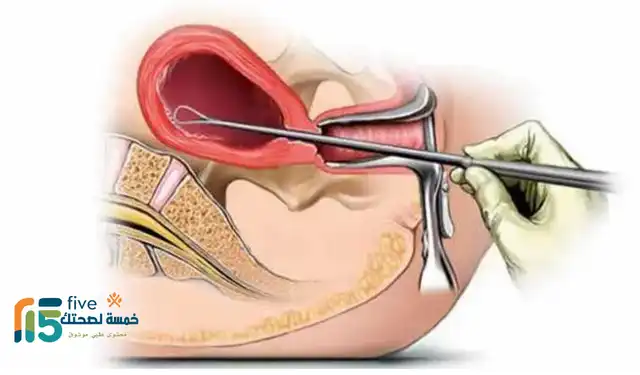 متى يبدأ مفعول ميزوتاك