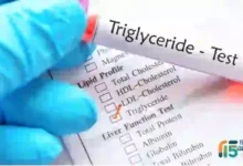 كيفية الاستعداد لتحليل الدهون الثلاثية