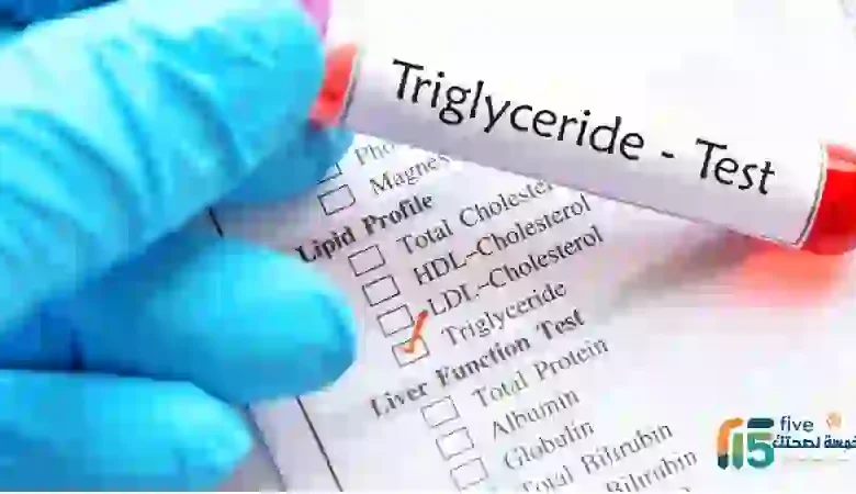 كيفية الاستعداد لتحليل الدهون الثلاثية