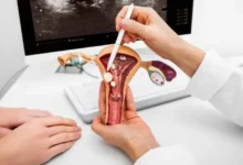 أضرار ميزوتاك على الرحم