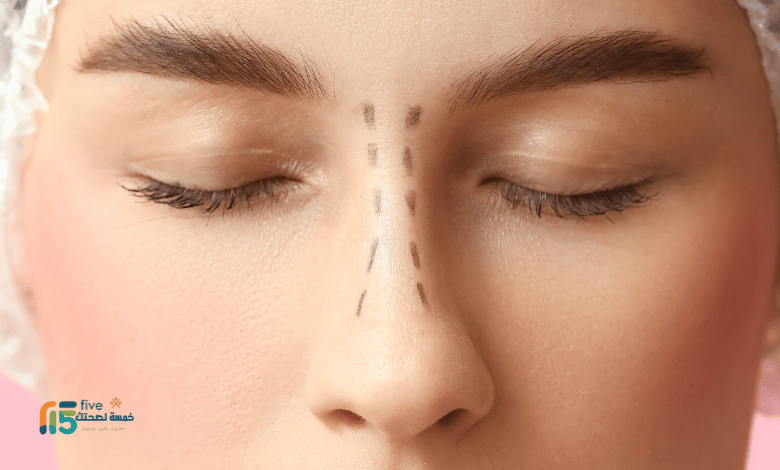 تجربتي مع تجميل الأنف بالليزر