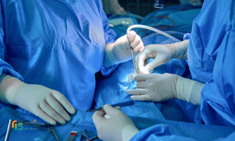 تجميل الخشم