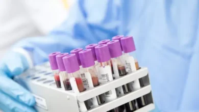 تحليل نقص الدم