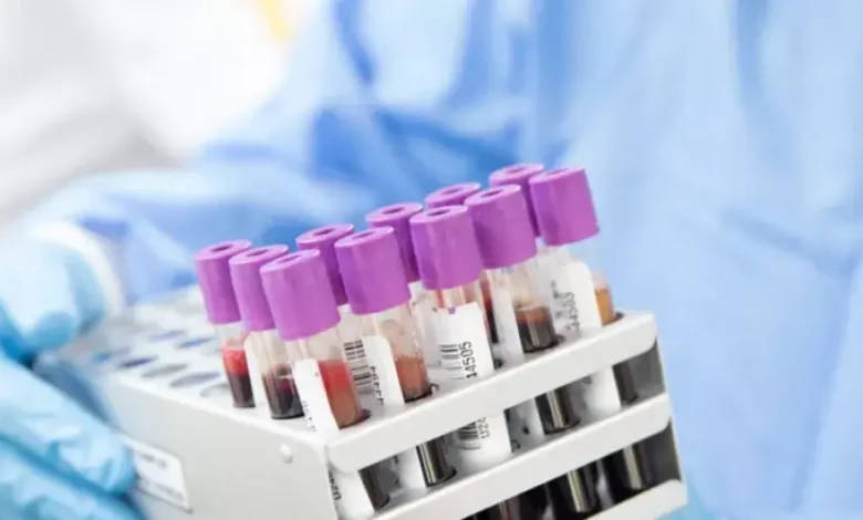 تحليل نقص الدم