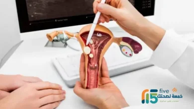 مفعول ميزوتاك للإجهاض