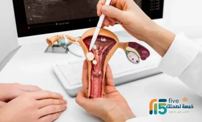 مفعول ميزوتاك للإجهاض