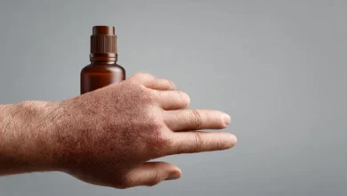 أضرار بيتادين على الجلد