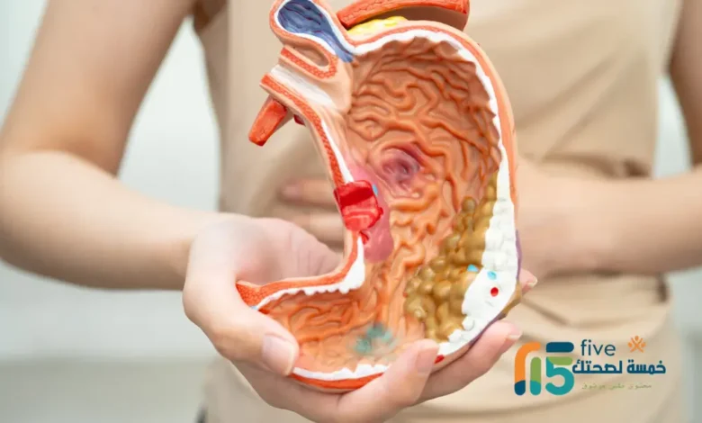 أضرار كيتولاك على المعدة