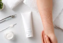 علاج الأكزيما نهائيا