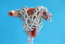 علاج مجرب للورم الليفي