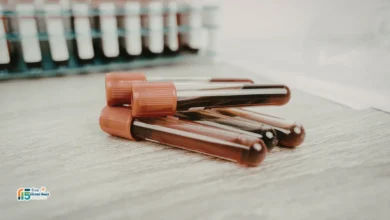 تحاليل الدم الشاملة