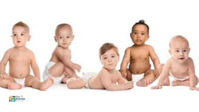 تسلخات الأطفال الشديدة