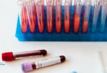 ماهي التحاليل الشاملة