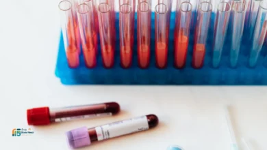 ماهي التحاليل الشاملة