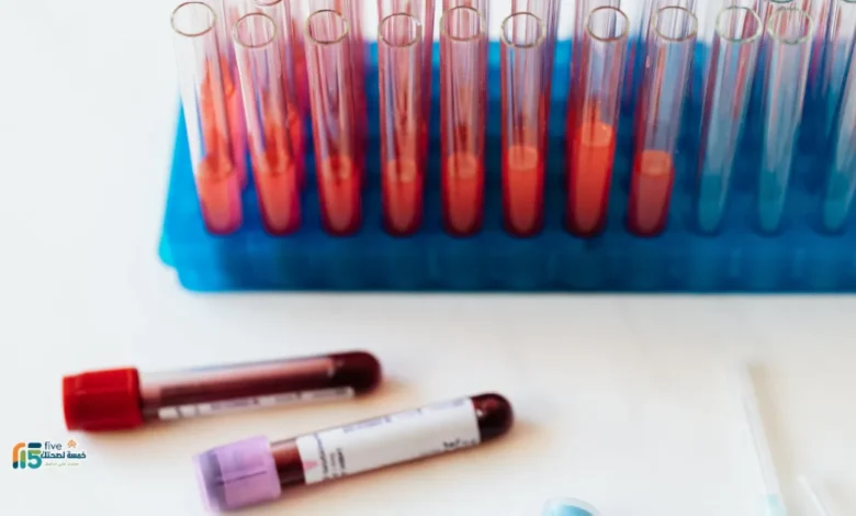 ماهي التحاليل الشاملة