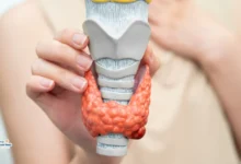 ورم الغدة الدرقية الحميد